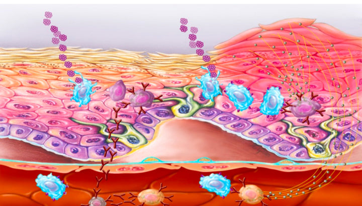 Dermatology Flashcards