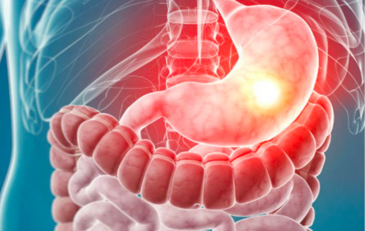 Gastroenterology Flashcards